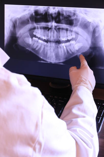 Best Emergency Broken Tooth Repair in Orange City, IA