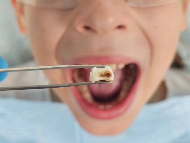 Best Pediatric Emergency Dentist in Orange City, IA